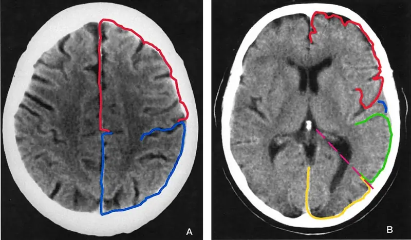 The Silent Killer" That Causes Brain Shrinkage — Yet Parents Still Feed It to Their Children Daily