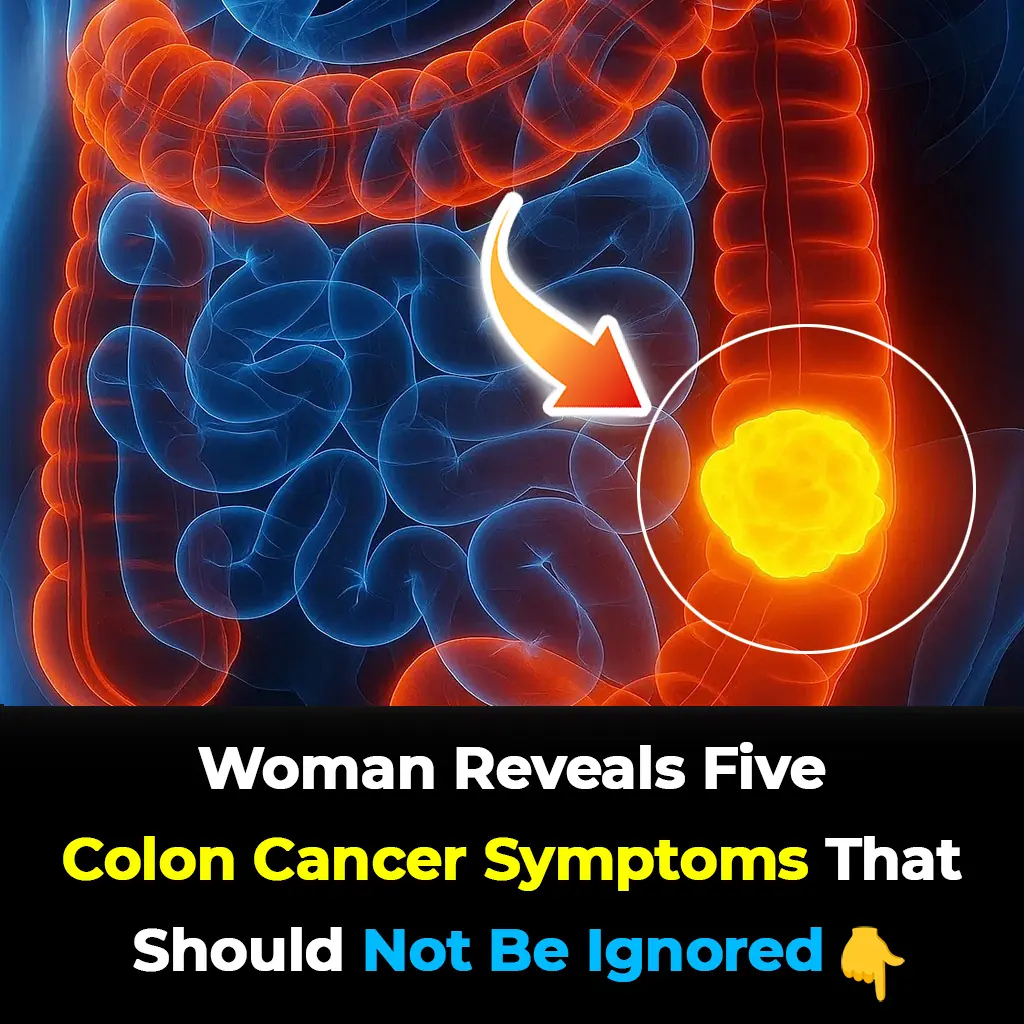 Woman Unveils 5 Colon Cancer Symptoms You Must Never Ignore