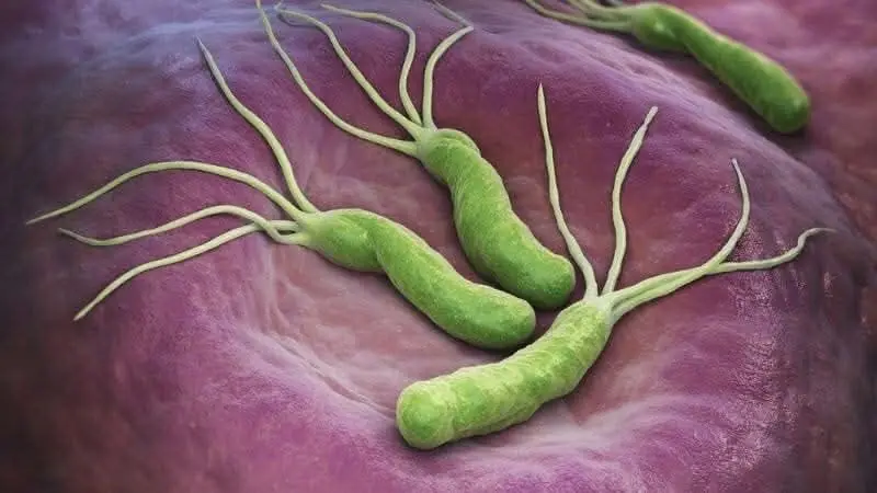 H. Pylori Fears These 5 Foods the Most — Eat Them to Protect Your Stomach