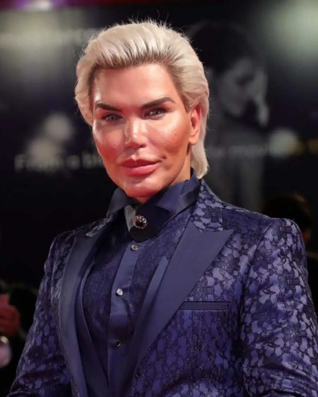$1M Plastic Surgery TV Star’s Transformation
