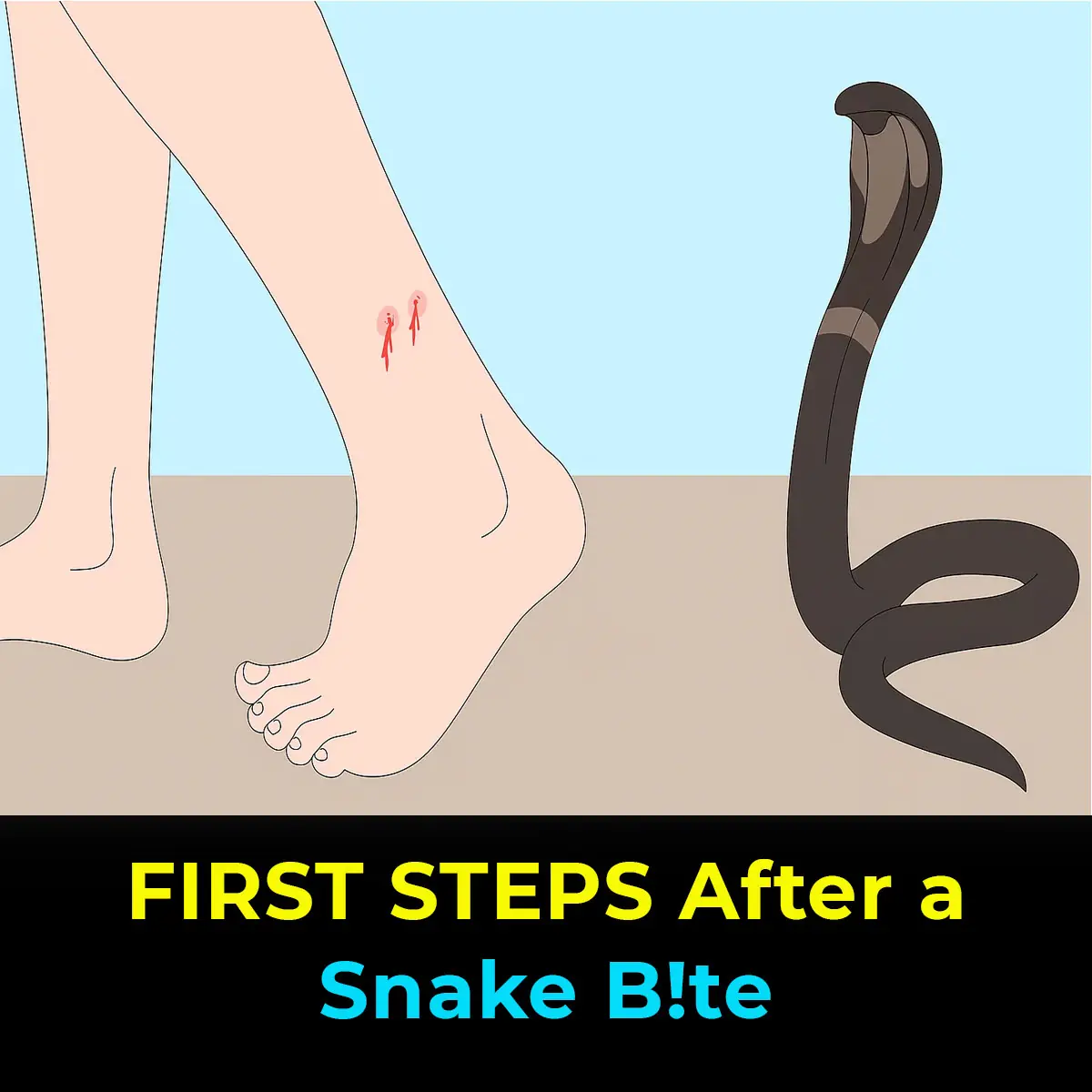 What to Do Immediately After a Snake Bite
