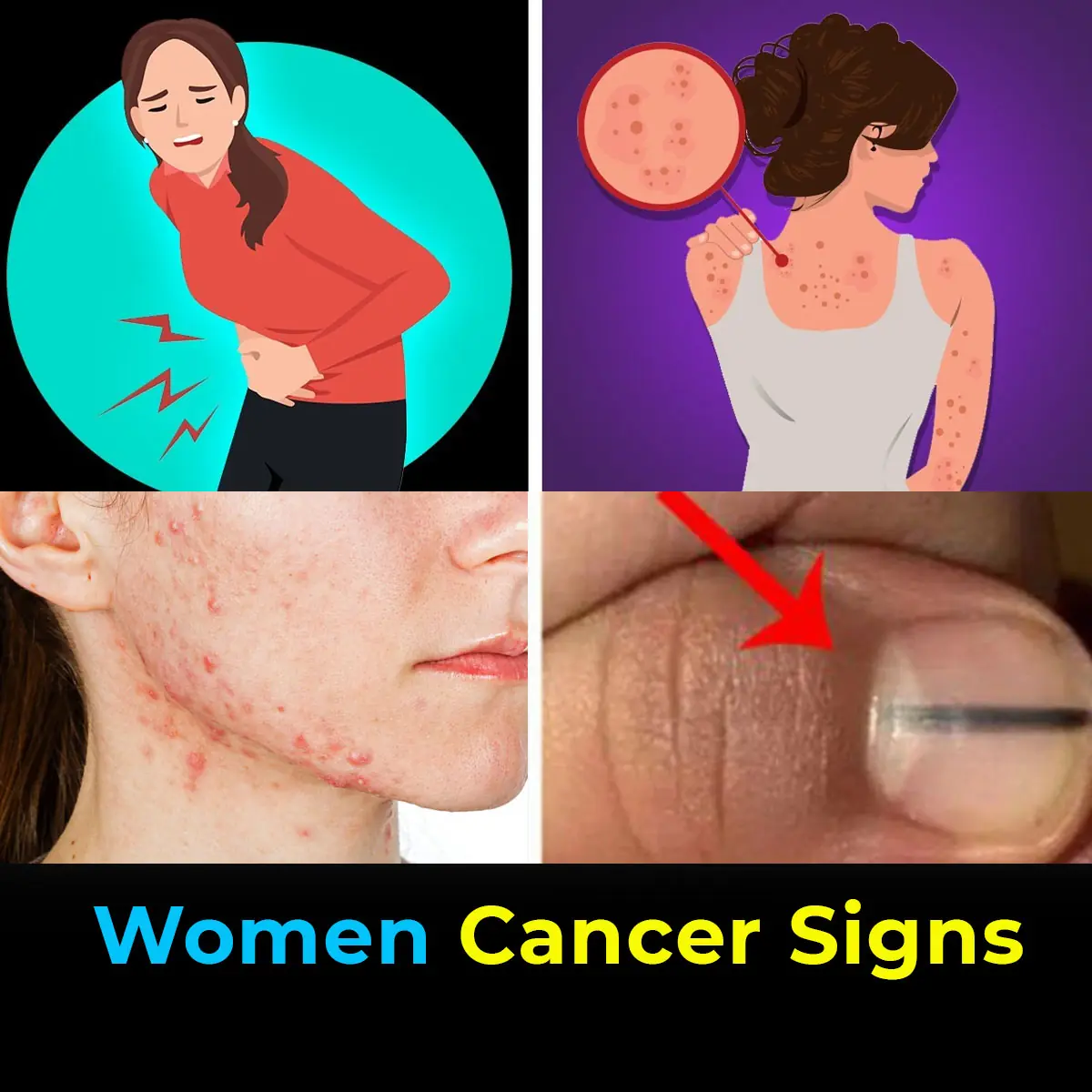 10 Cancer Warning Signs Women Often Overlook