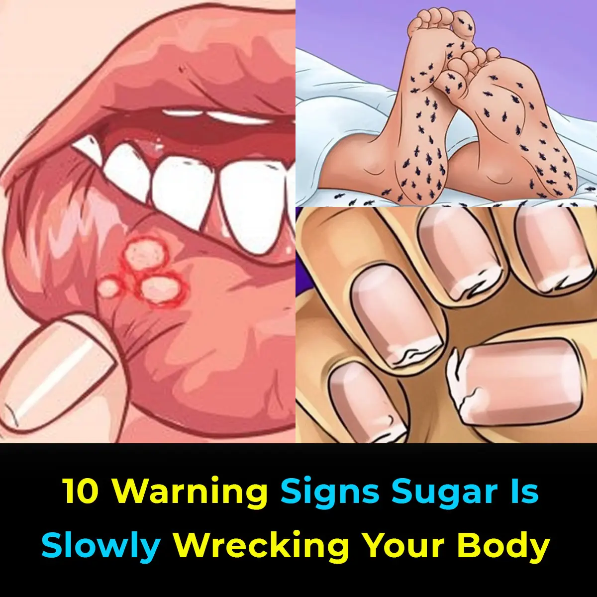 10 Warning Signs Sugar Is Slowly Wrecking Your Body