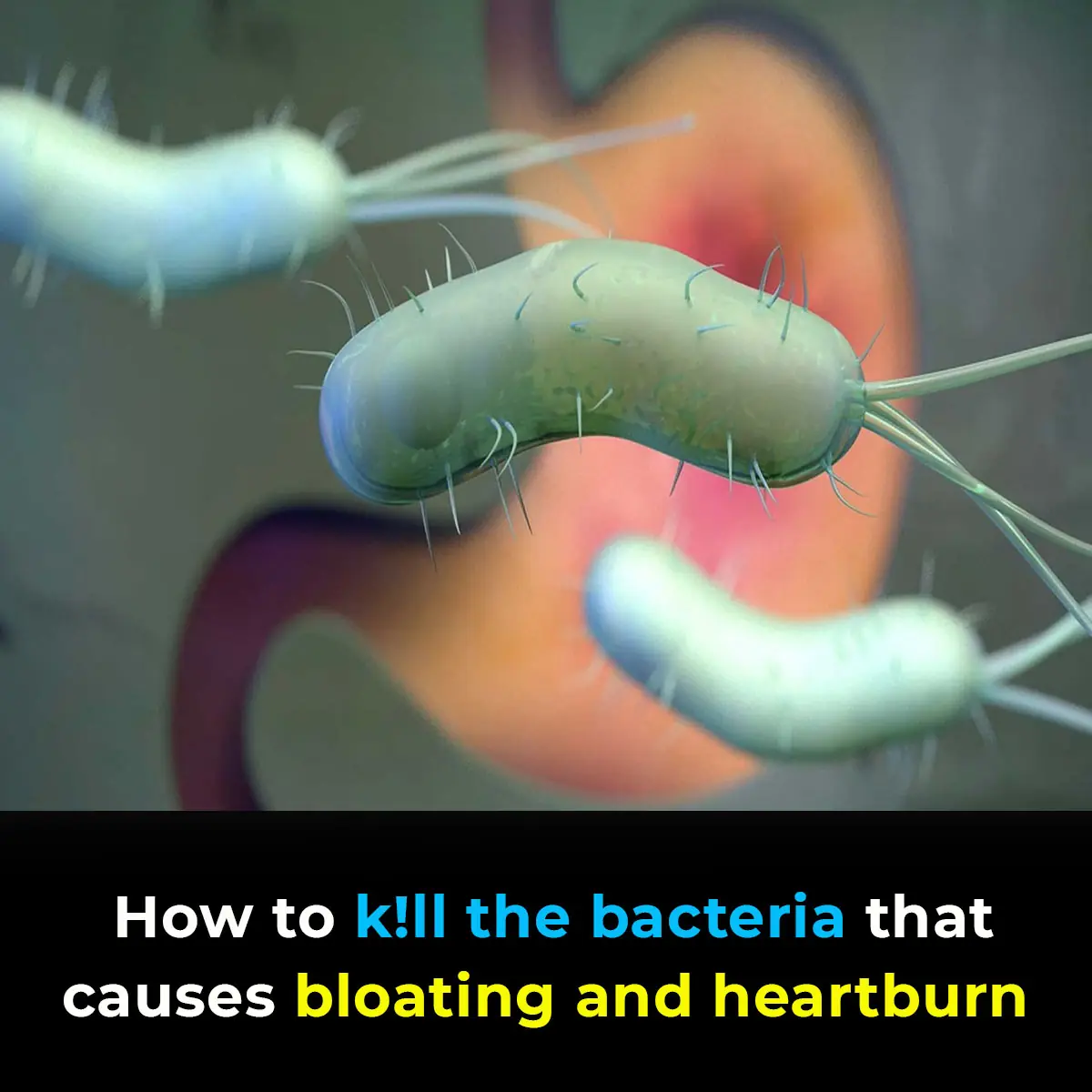 How to Treat H. Pylori (Helicobacter Pylori) Naturally Without Antibiotics