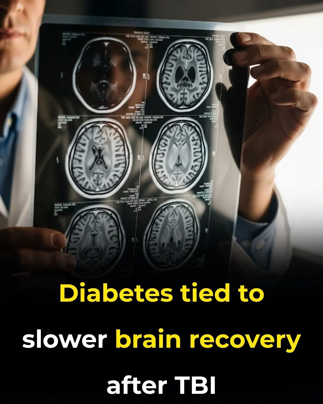 Diabetes Tied to Slower Brain Recovery After TBI