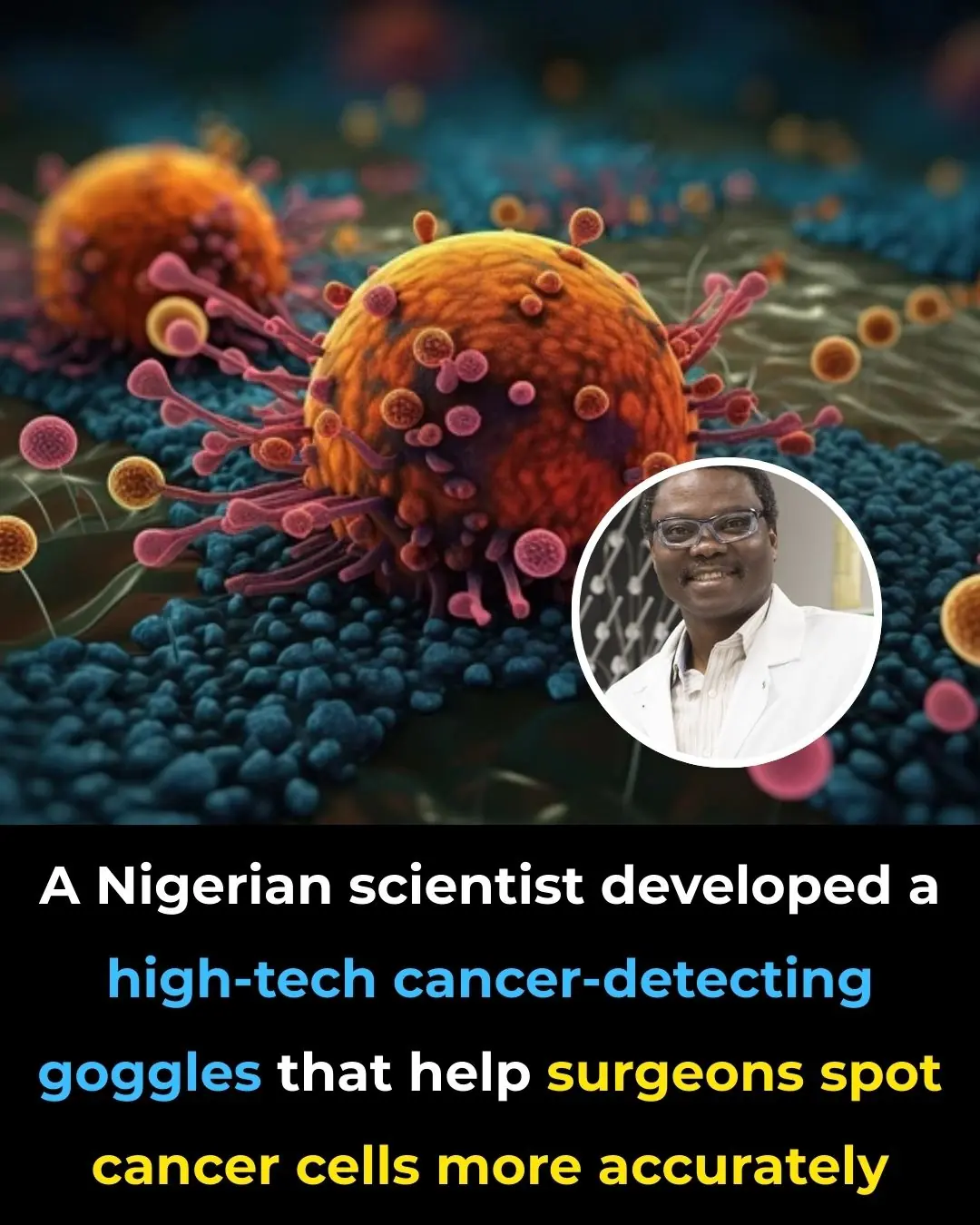 A Nigerian Scientist Developed a High-Tech Cancer-Detecting Goggles That Help Surgeons Spot Cancer Cells More Accurately.