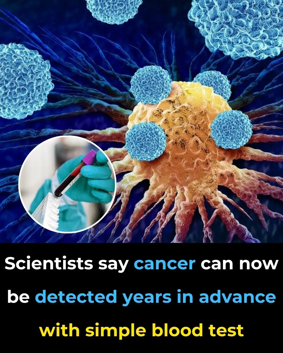 Scientists Say Cancer Can Now Be Detected Years in Advance with Simple Blood Test