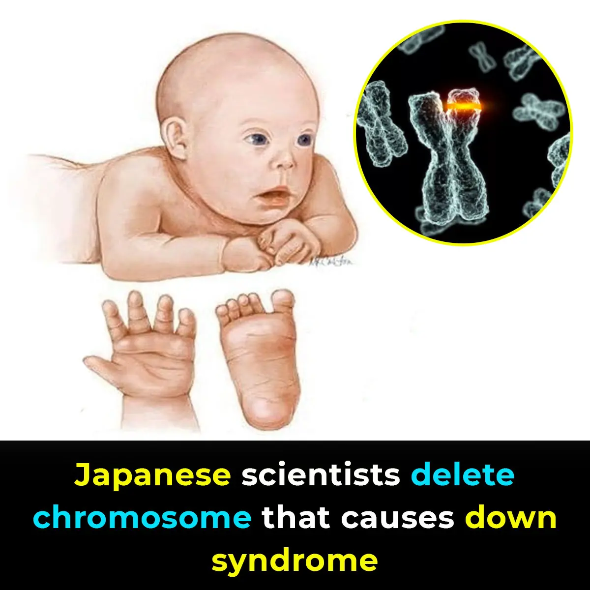 Japanese scientists delete chromosome that causes down syndrome