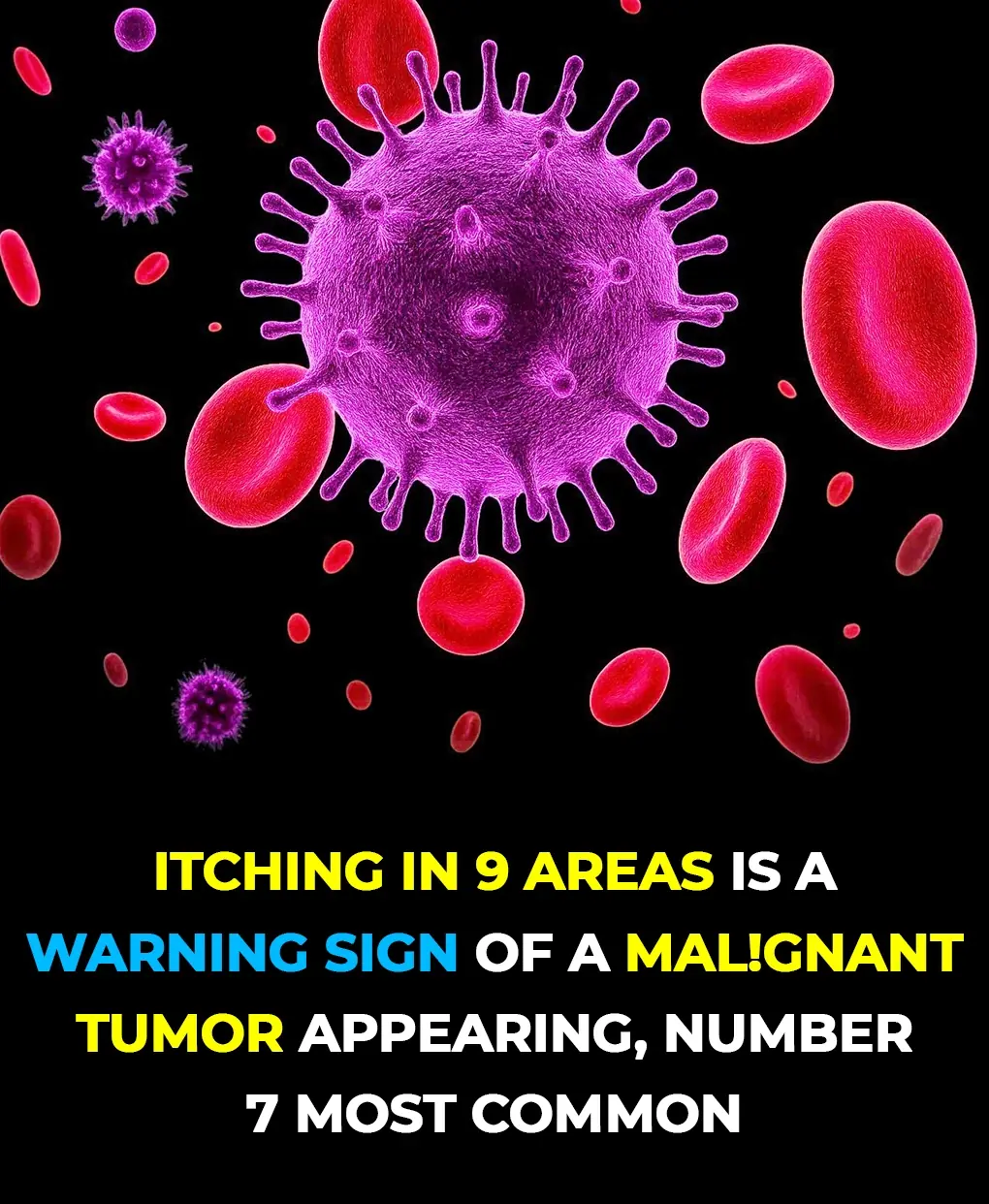 9 Areas Where Itching Could Signal Malignant Tumors — #7 Happens Most Often
