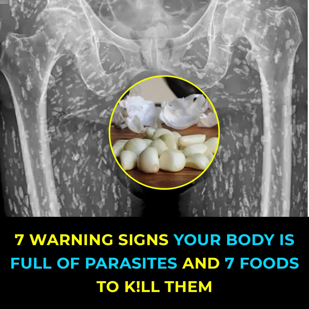 10 Warning Signs of Parasites in Your Body