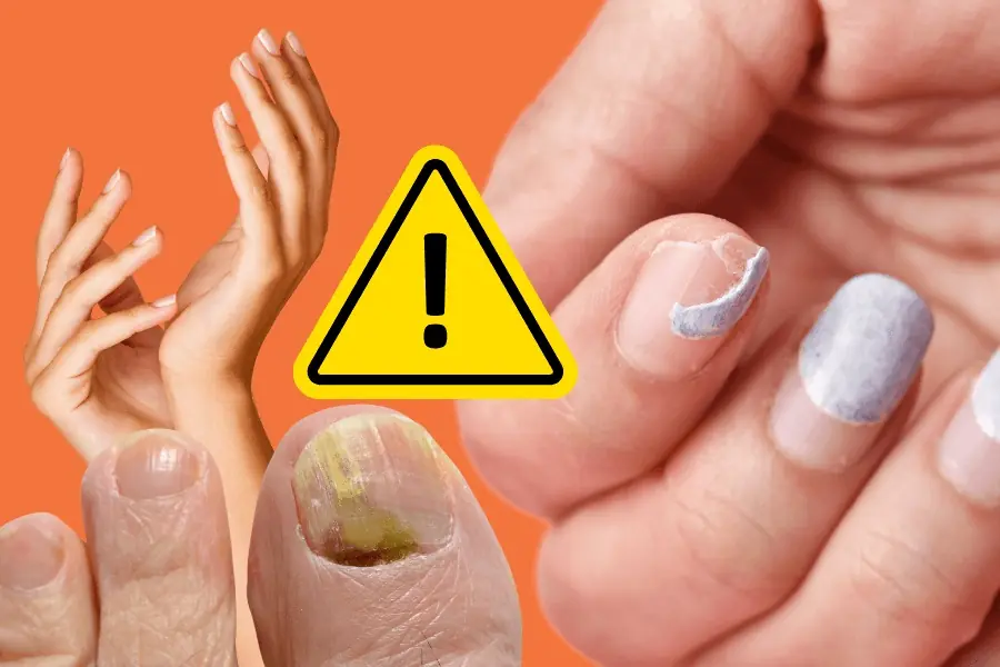 Experts Reveal 11 Hidden Health Warnings You Can Spot Just by Looking at Your Nails