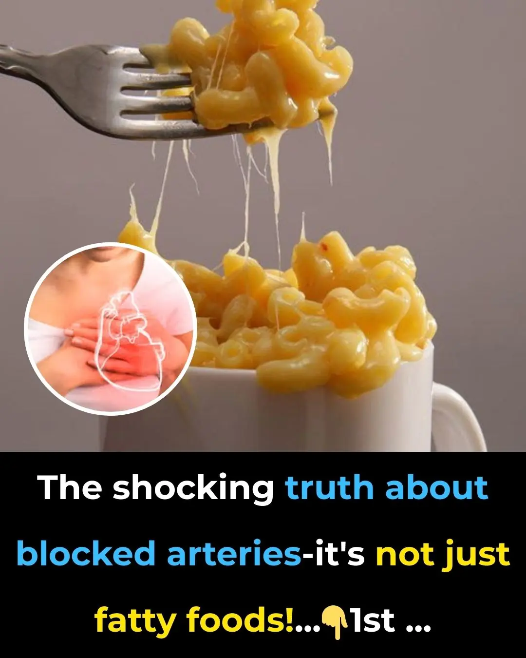 The shocking truth about blocked arteries—it’s NOT just fatty foods!