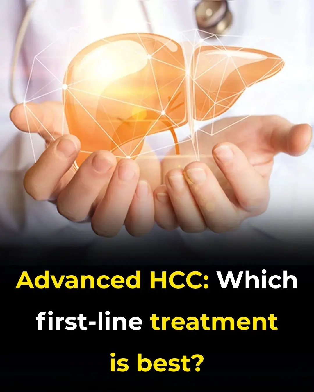 Advanced HCC: Which First-line Treatment Is Best?