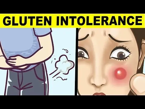 Think You’re Fine? These 10 Hidden Signs of Gluten Intolerance Will Surprise You