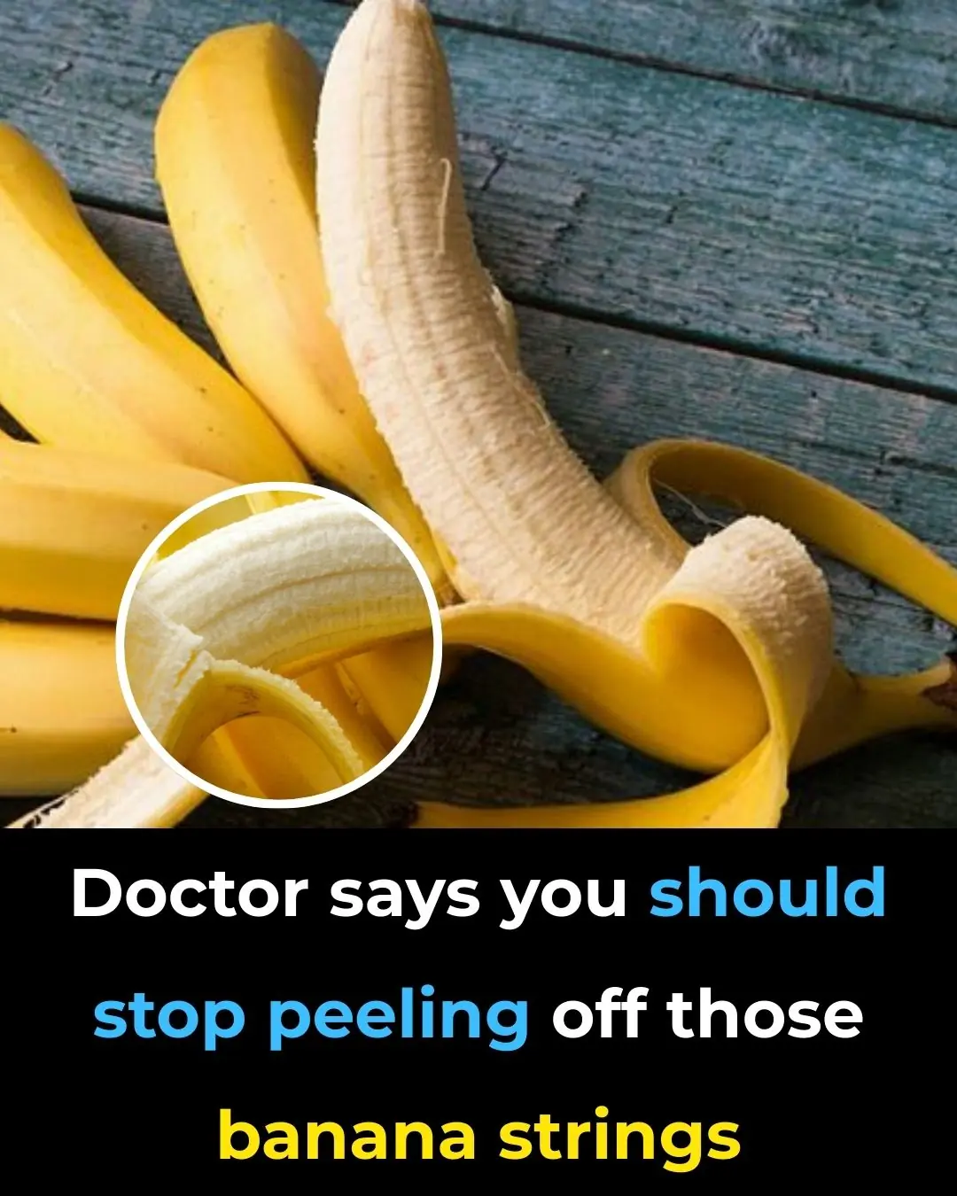 Doctor Says You Should Stop Peeling Off Those Banana Strings