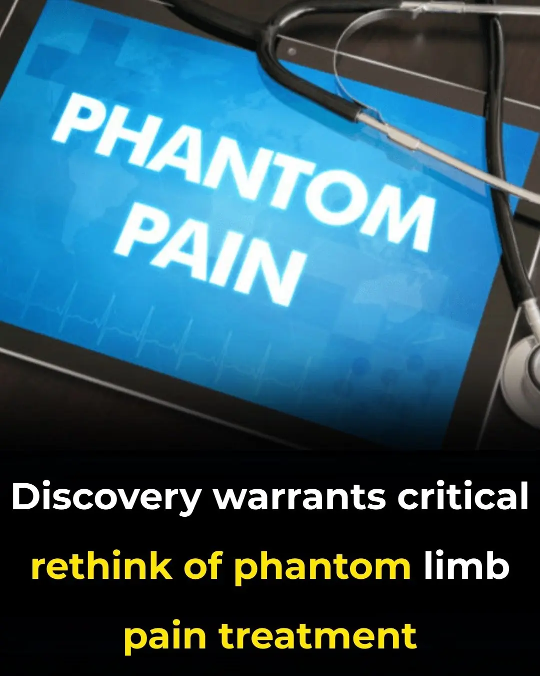 Discovery Warrants Critical Rethink of Phantom Limb Pain Treatment