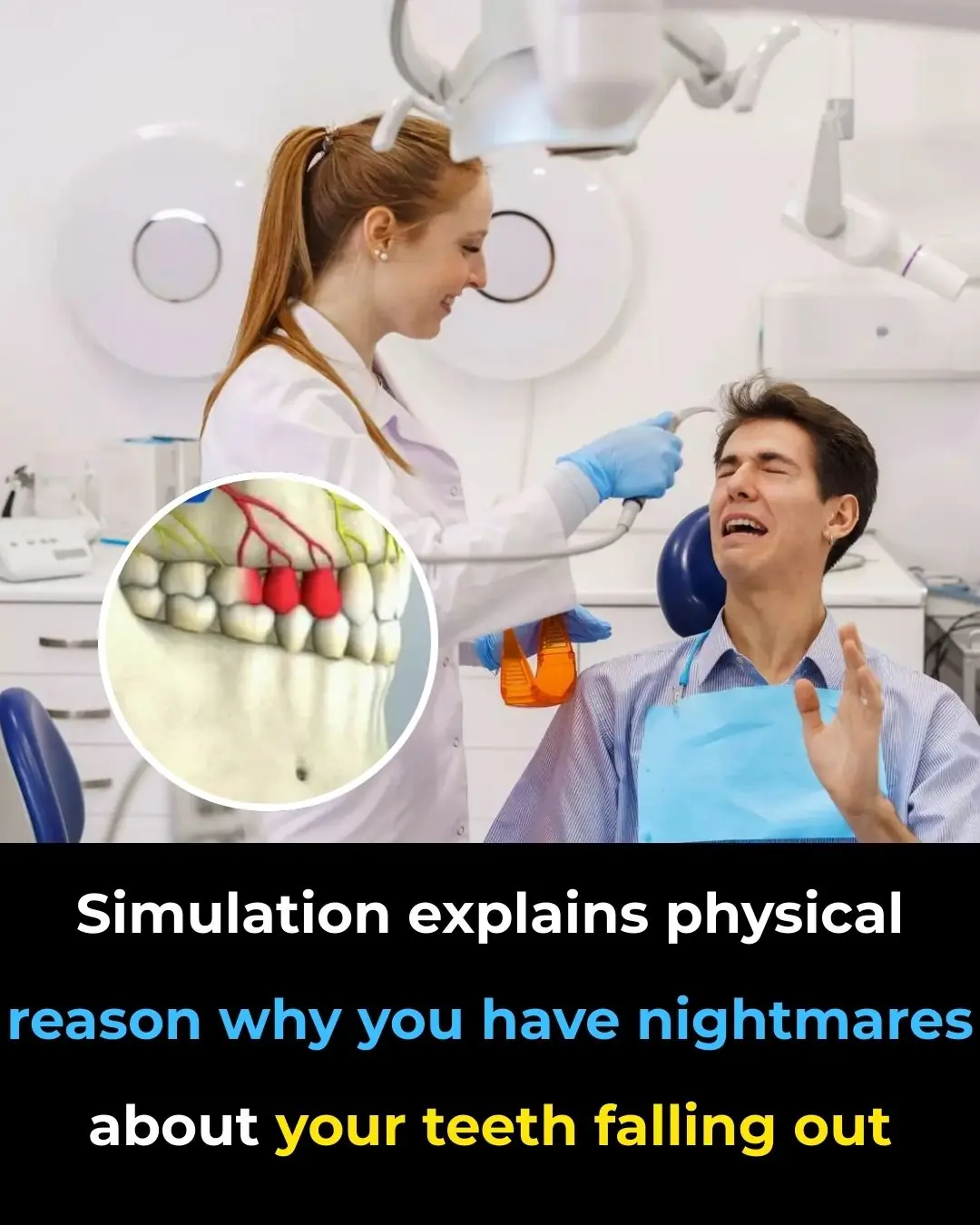 Simulation Reveals the Science Behind Nightmares of Losing Teeth