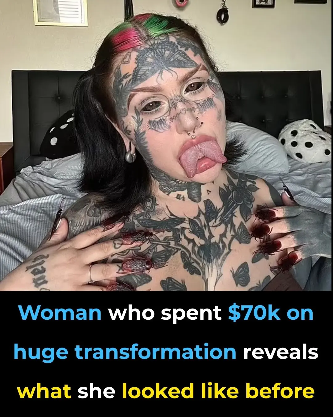 She Spent $70,000 on Cosmetic Procedures — Now She’s Owning Her Beauty Despite the Backlash