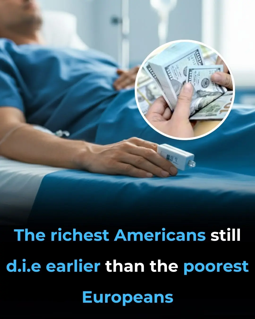 The Richest Americans Still Die Earlier Than the Poorest Europeans