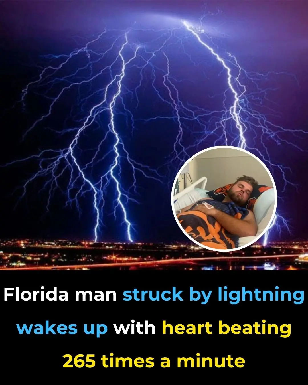 Florida Man Struck by Lightning Wakes Up With Heart Beating 265 Times a Minute