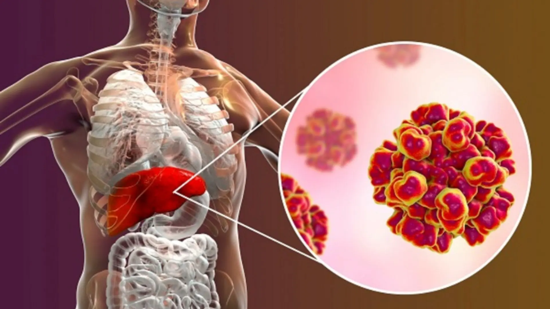10 Unconventional Signs of Liver Damage You Must Know About