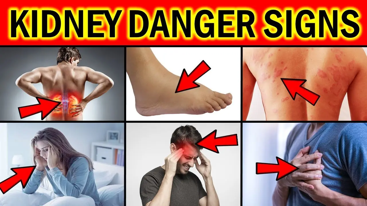 Do Not Ignore These 10 Warning Signs That Your Kidneys May Be In Danger