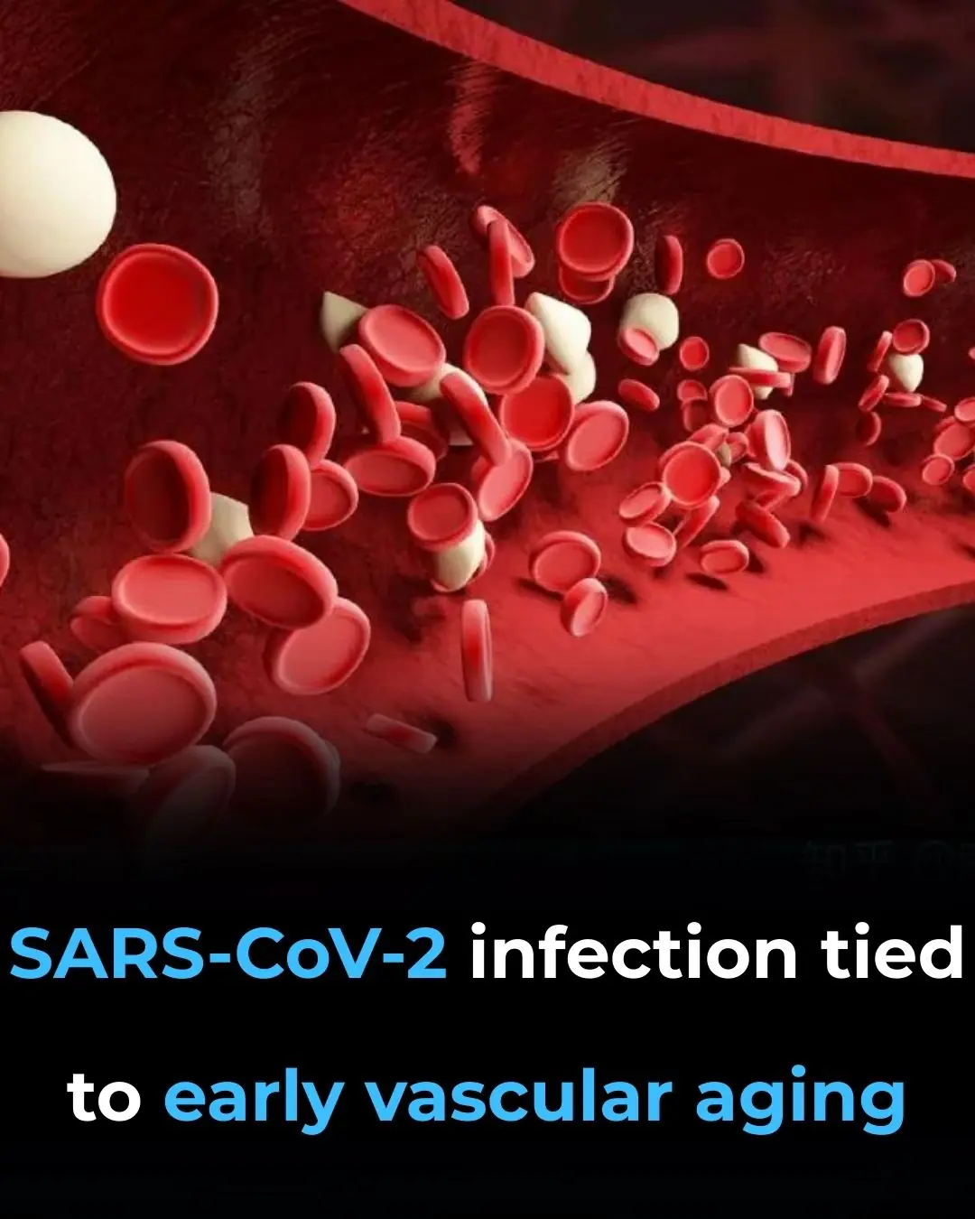 SARS-CoV-2 Infection Tied to Early Vascular Aging