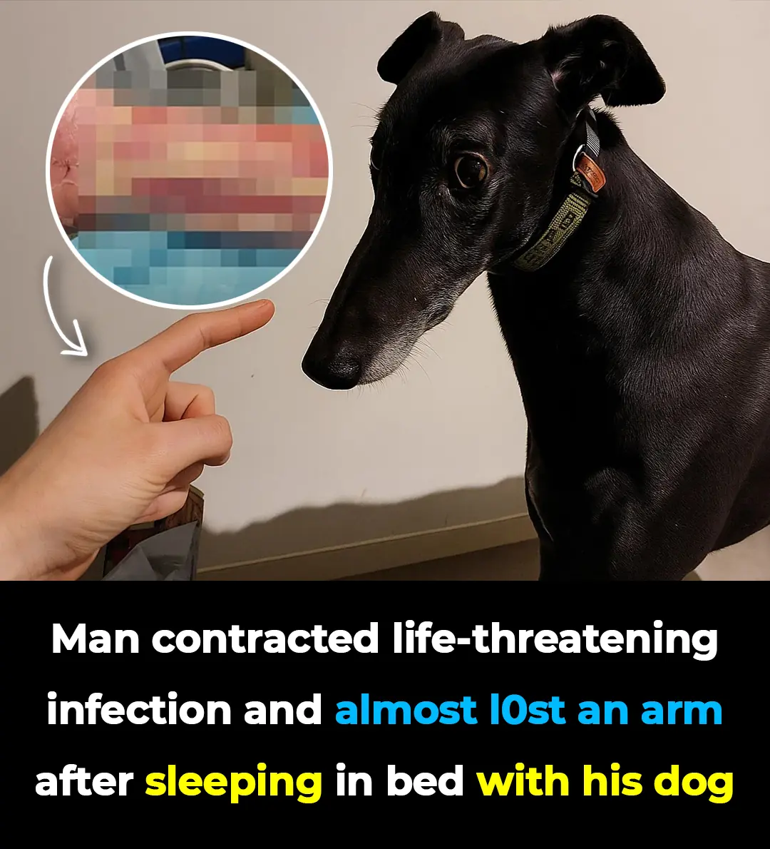 Man contracted life-threatening infection and almost lost an arm after sleeping in bed with his dog