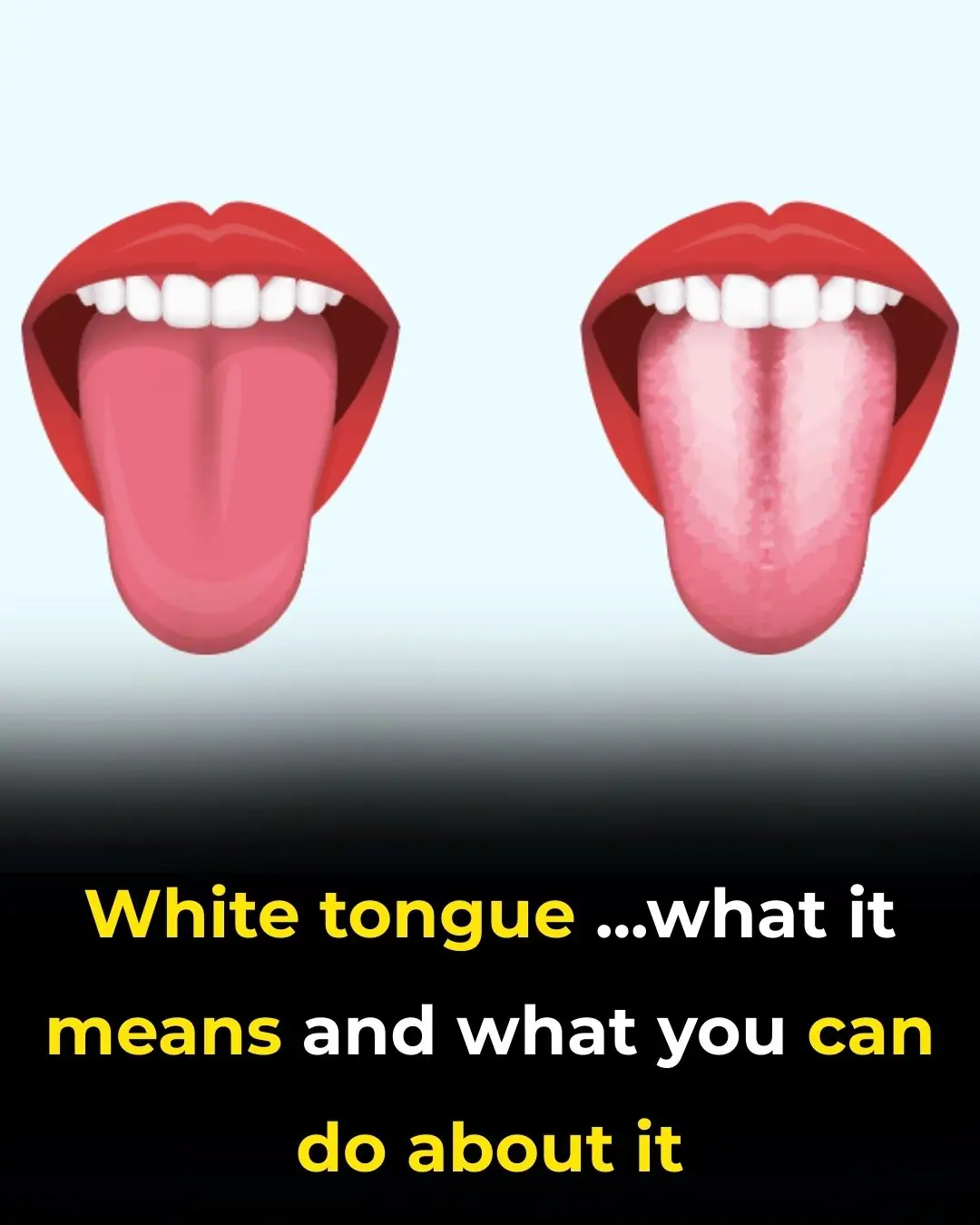 White Tongue …What It Means and What You Can Do About It