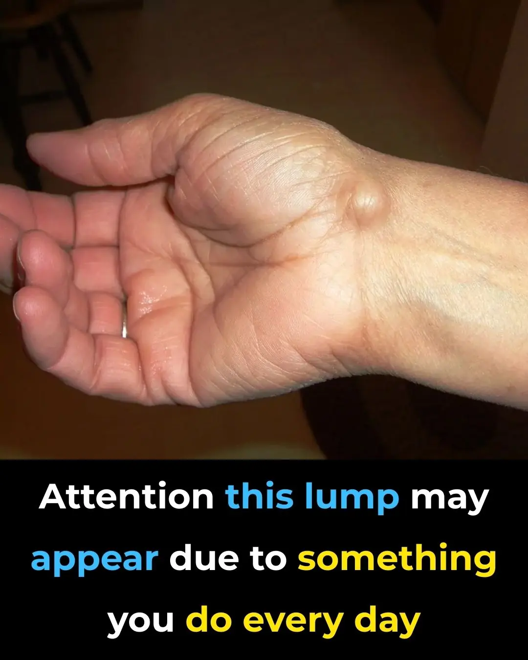 Everyday Habits That Can Cause a This Issue To Your Hands