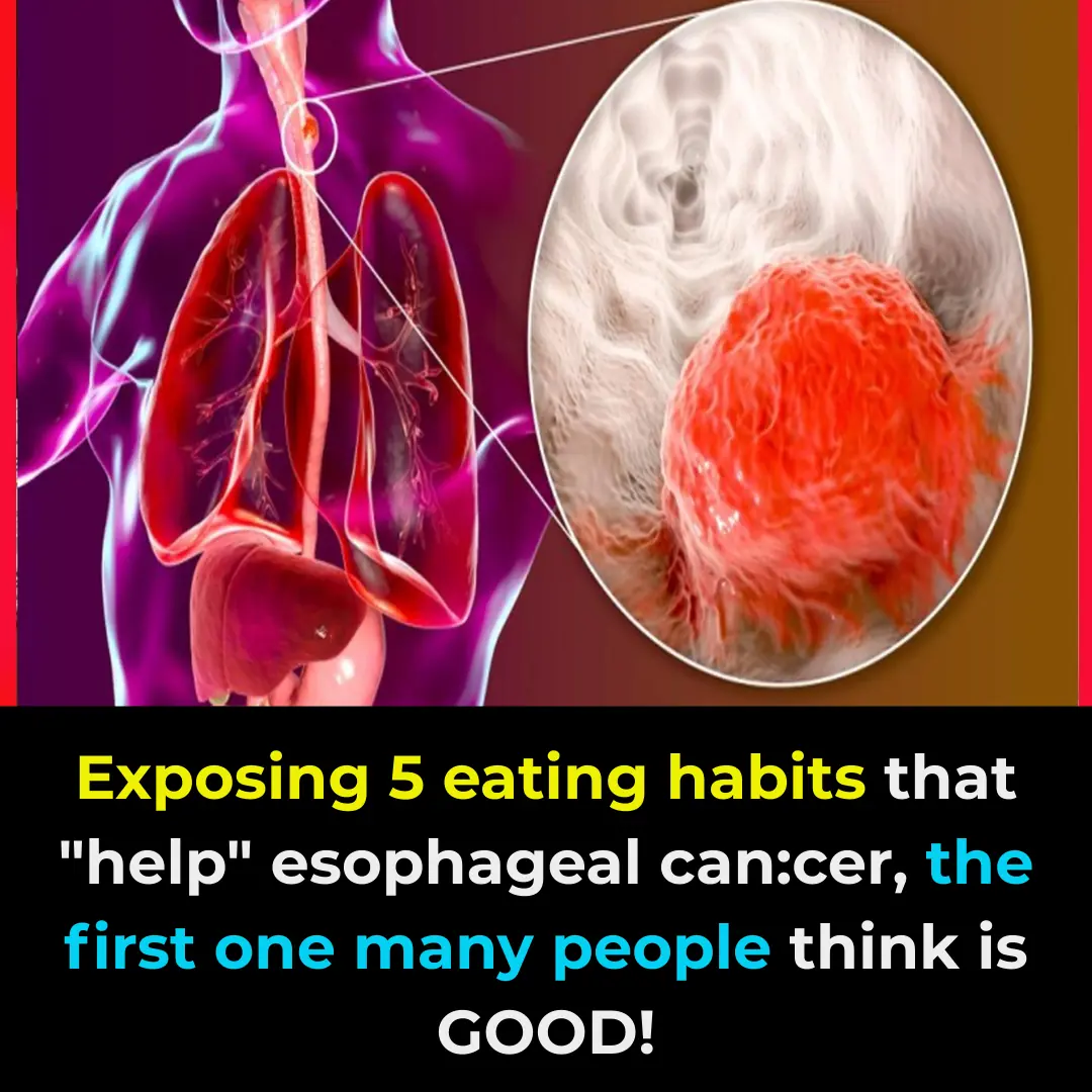 If you don’t correct these 5 harmful eating and drinking habits right away, sooner or later your esophagus will also be “ravaged” by cancer cells.
