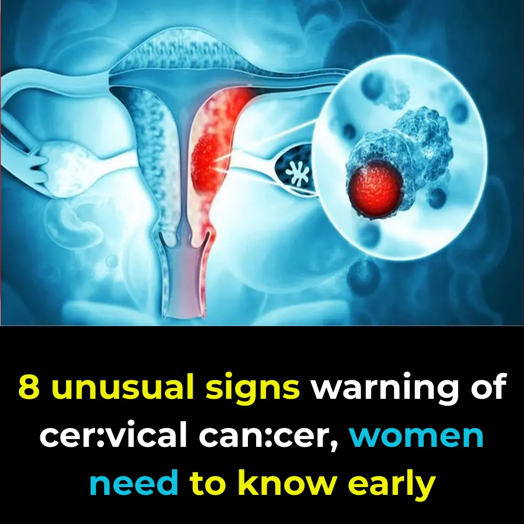 "8 abnormal signs warning of c3rvical canc3r that women need to recognize early"