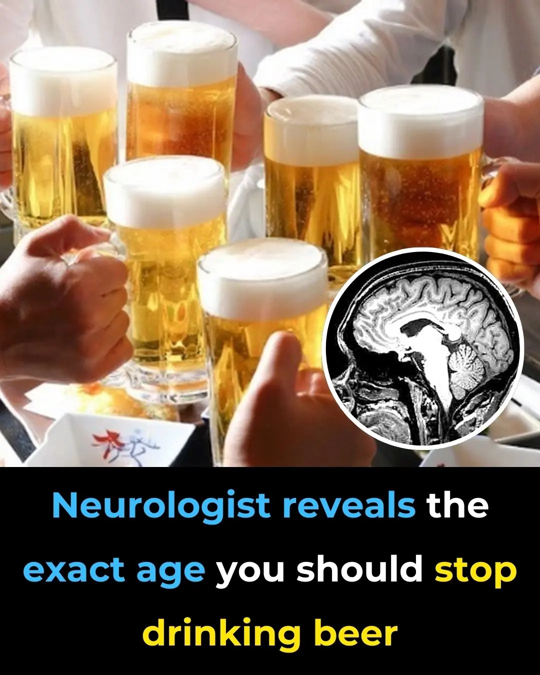 Neurologist Advises Ceasing Beer Consumption by Age 65