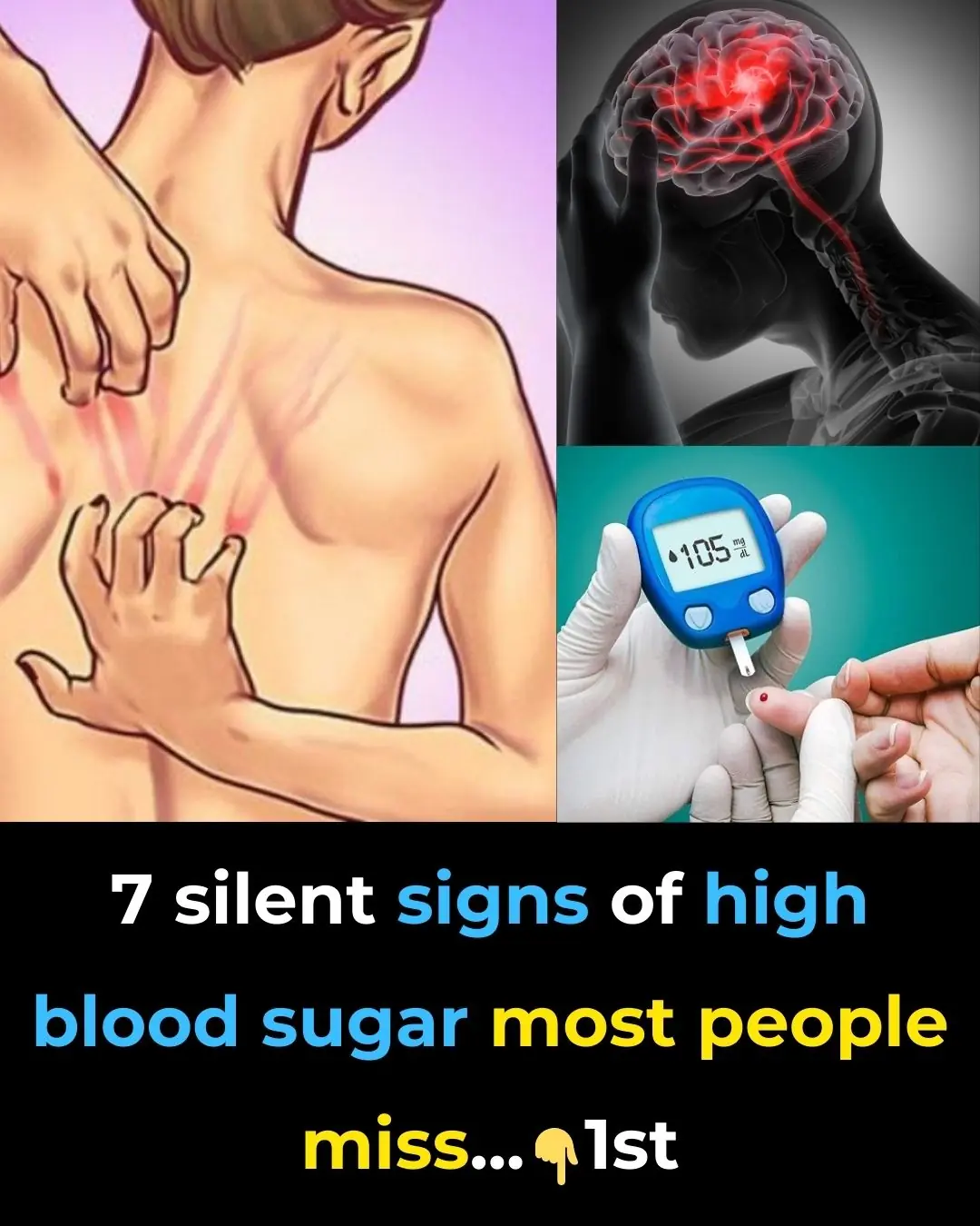7 silent signs of high blood sugar most people miss
