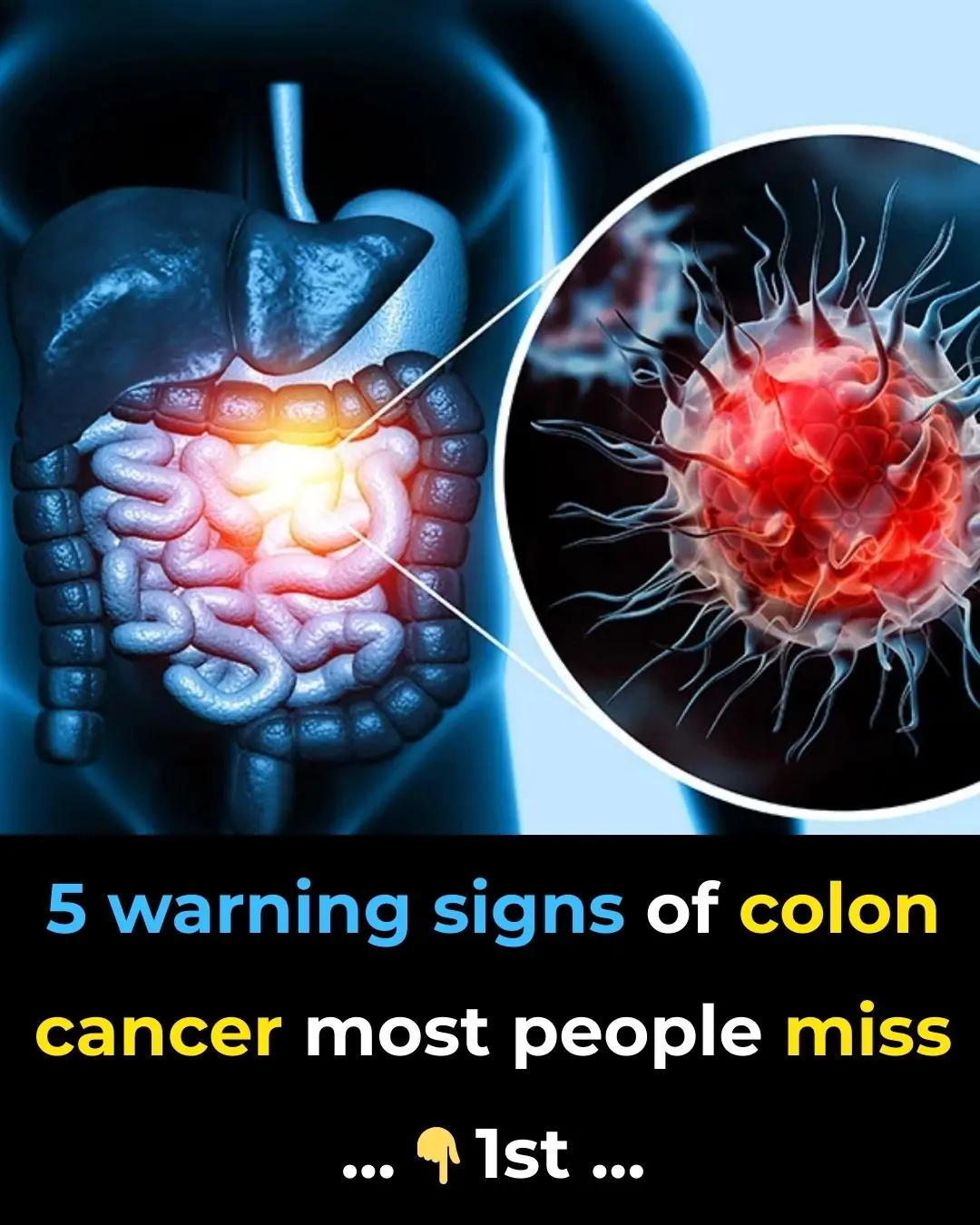 5 Unusual Signs Of Colon Cancer Folks Accidentally Ignore For Years