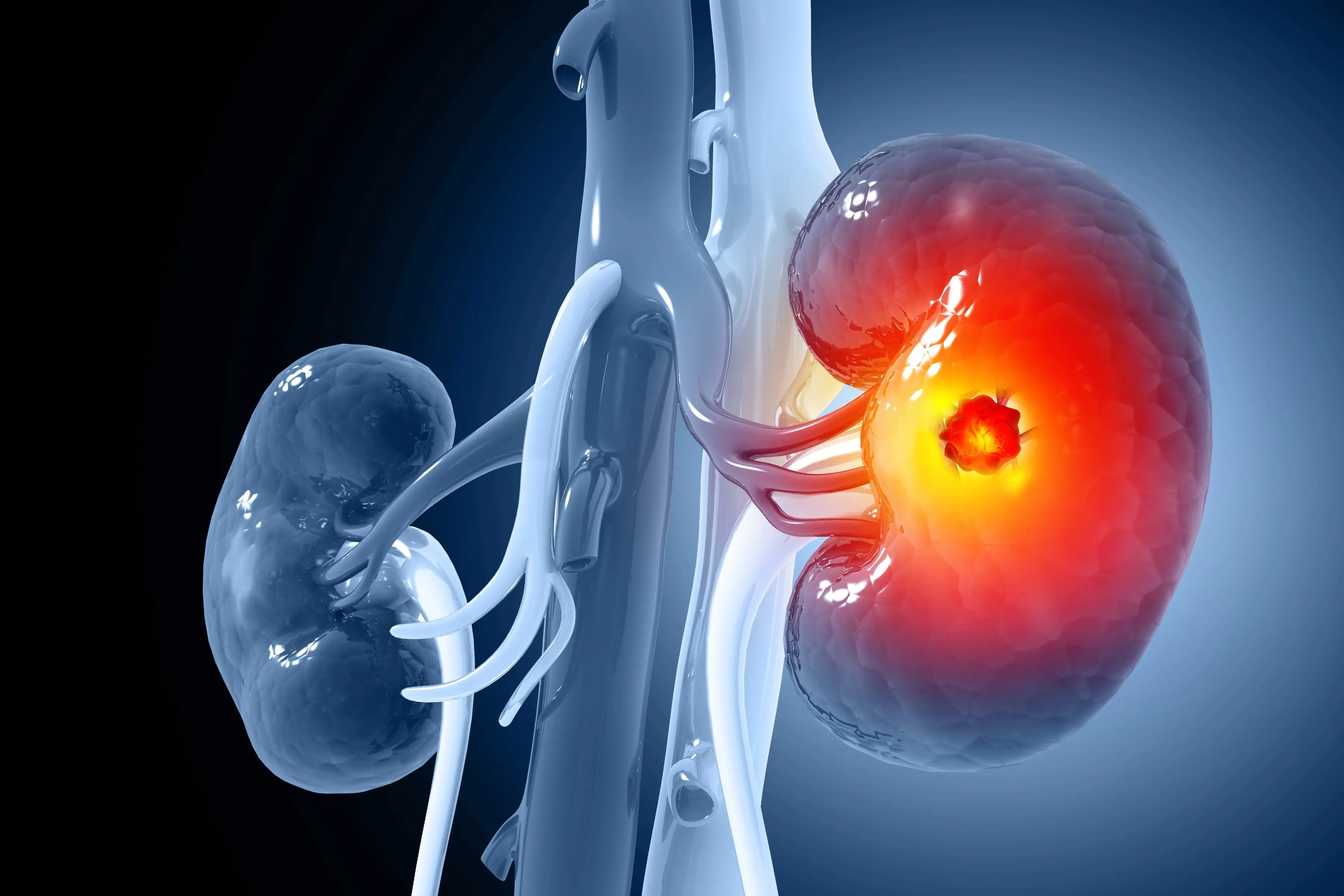If You’re Experiencing THESE Symptoms, Your Kidneys May Be at Risk