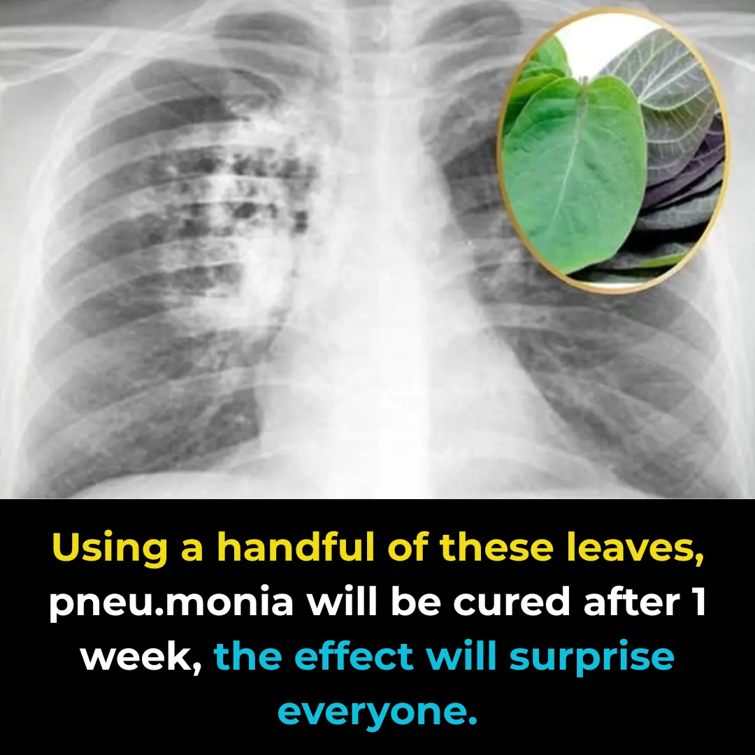 Using just a handful of Paederia foetida leaves, even severe lung inflammation can clear within a week — with results that surprise everyone.