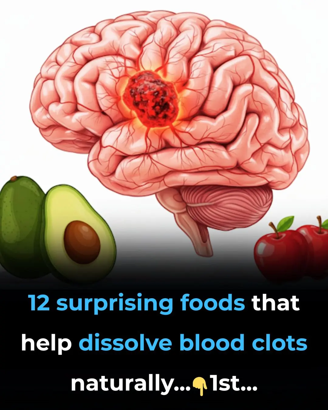 12 surprising foods that help dissolve blood clots naturally