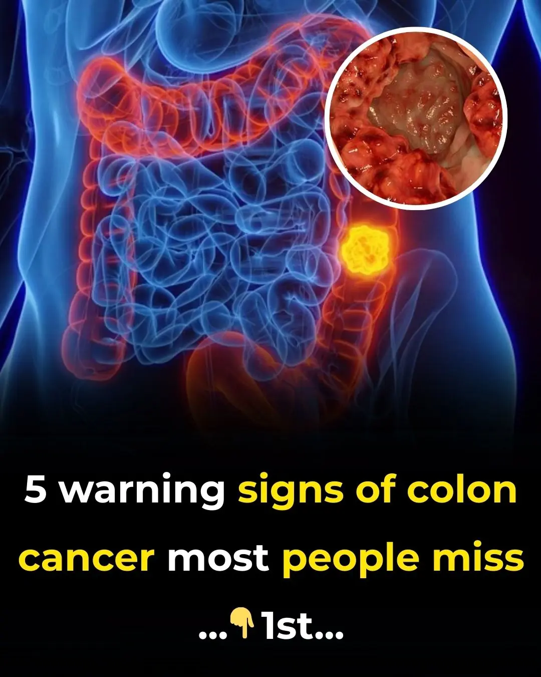 5 Unusual Signs Of Colon Cancer Folks Accidentally Ignore For Years