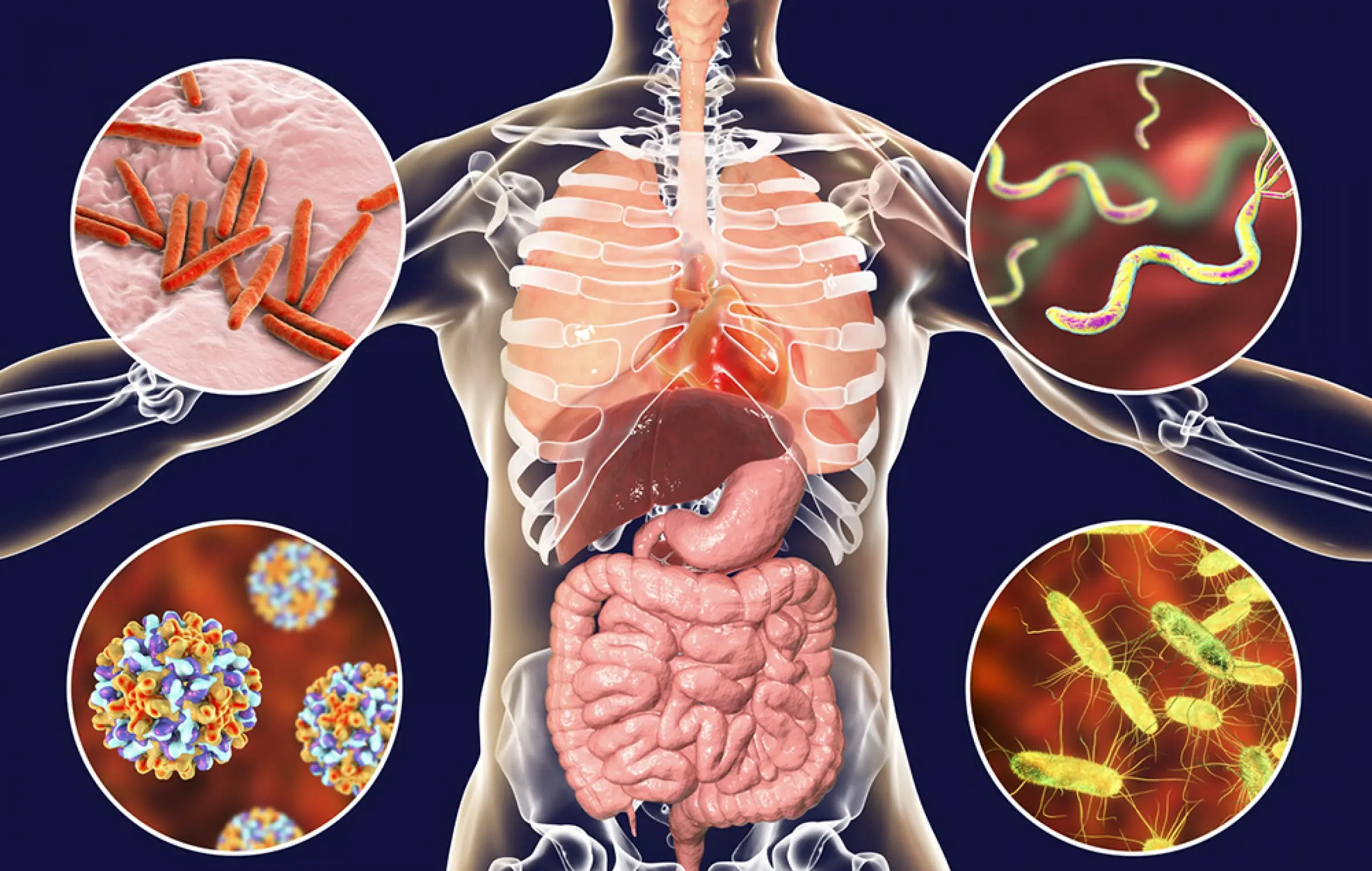 How to Get Rid of Worms in Humans (Including Parasite Cleanse Diet)