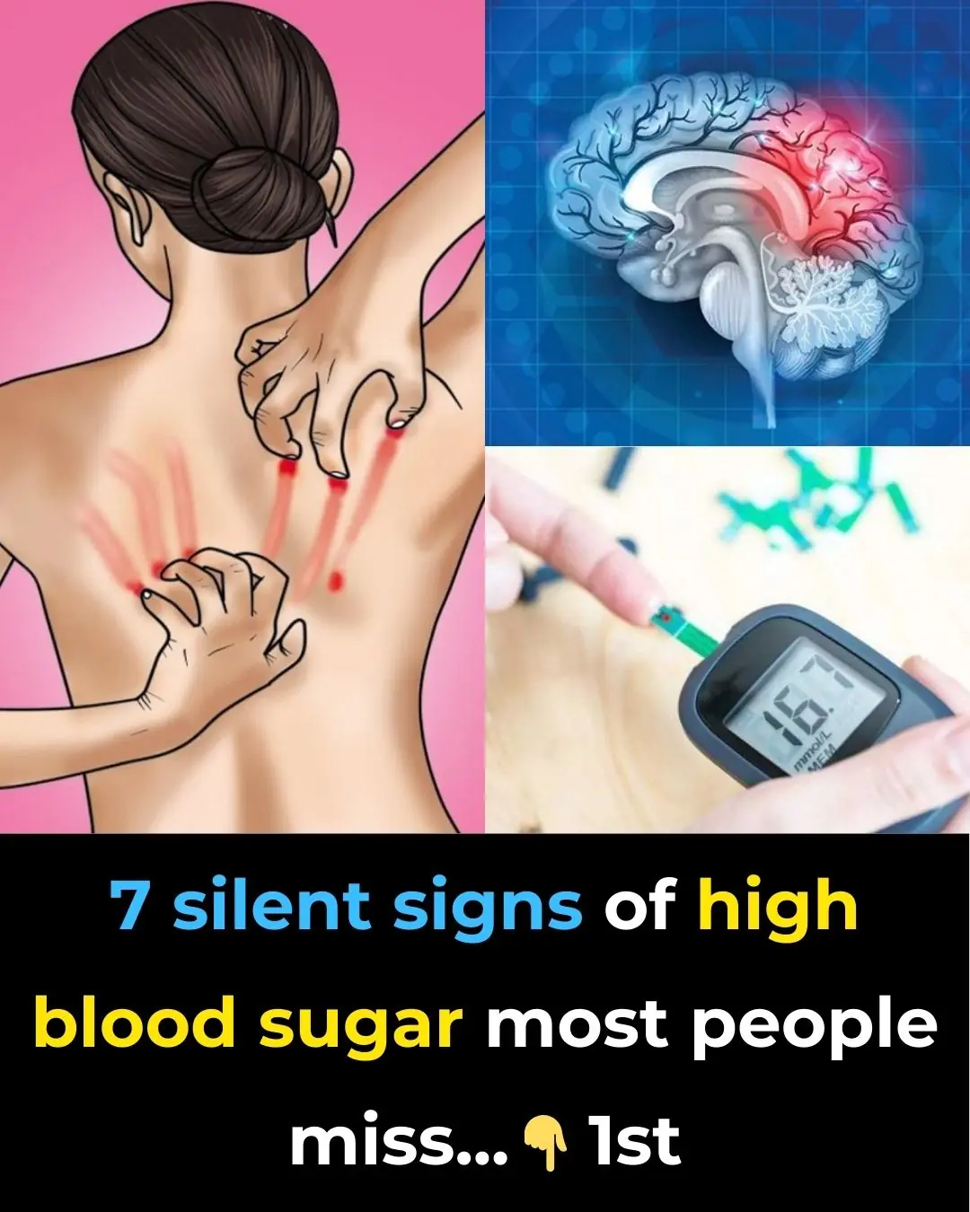 7 silent signs of high blood sugar most people miss