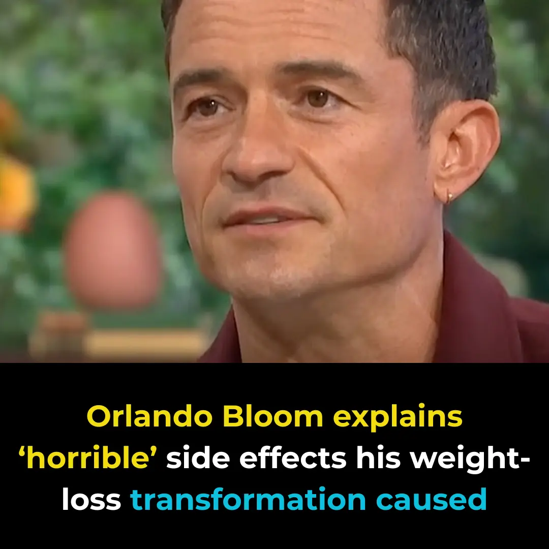 Orlando Bloom explains ‘horrible’ side effects his weight-loss transformation caused