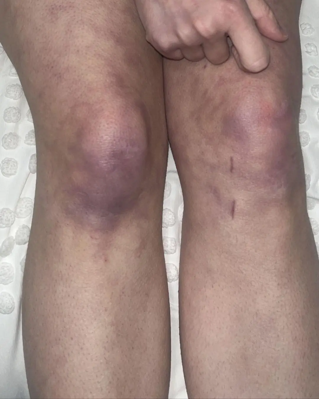 What those strange skin patterns might really mean