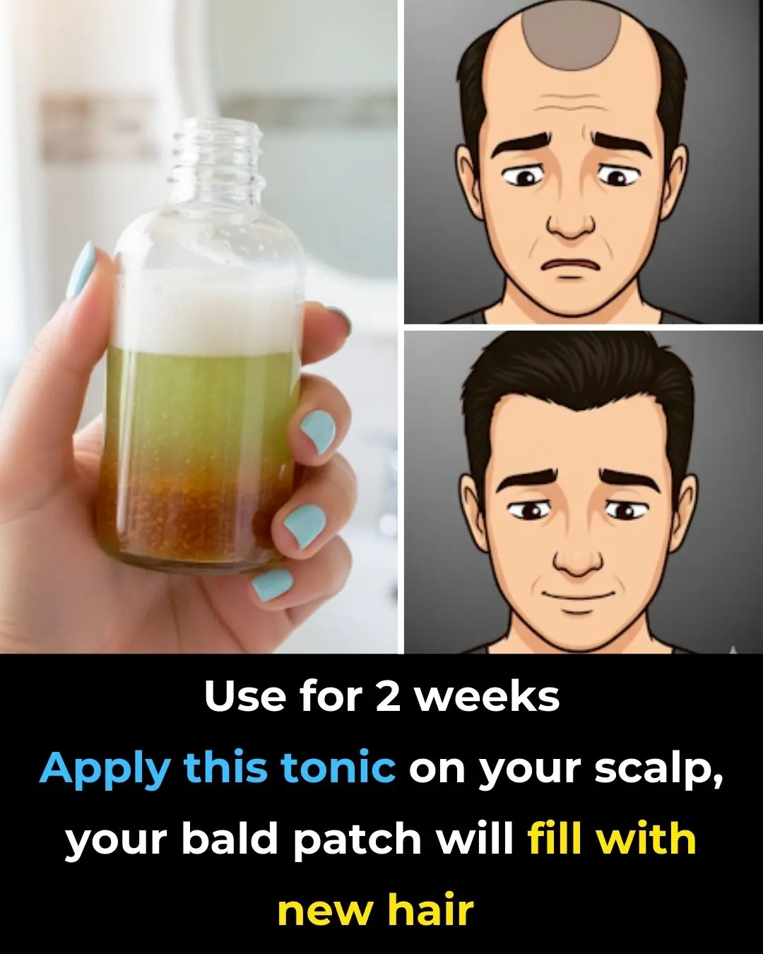 Homemade Tonic For Thick Hair Growth