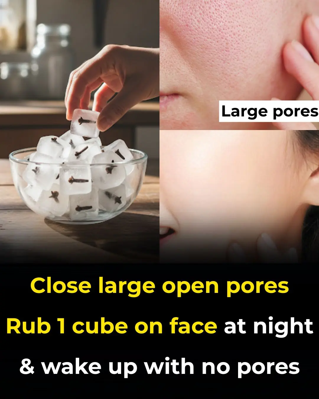 Clove benefits for Skin – Clove Oil, Clove Gel & Clove ice cubes