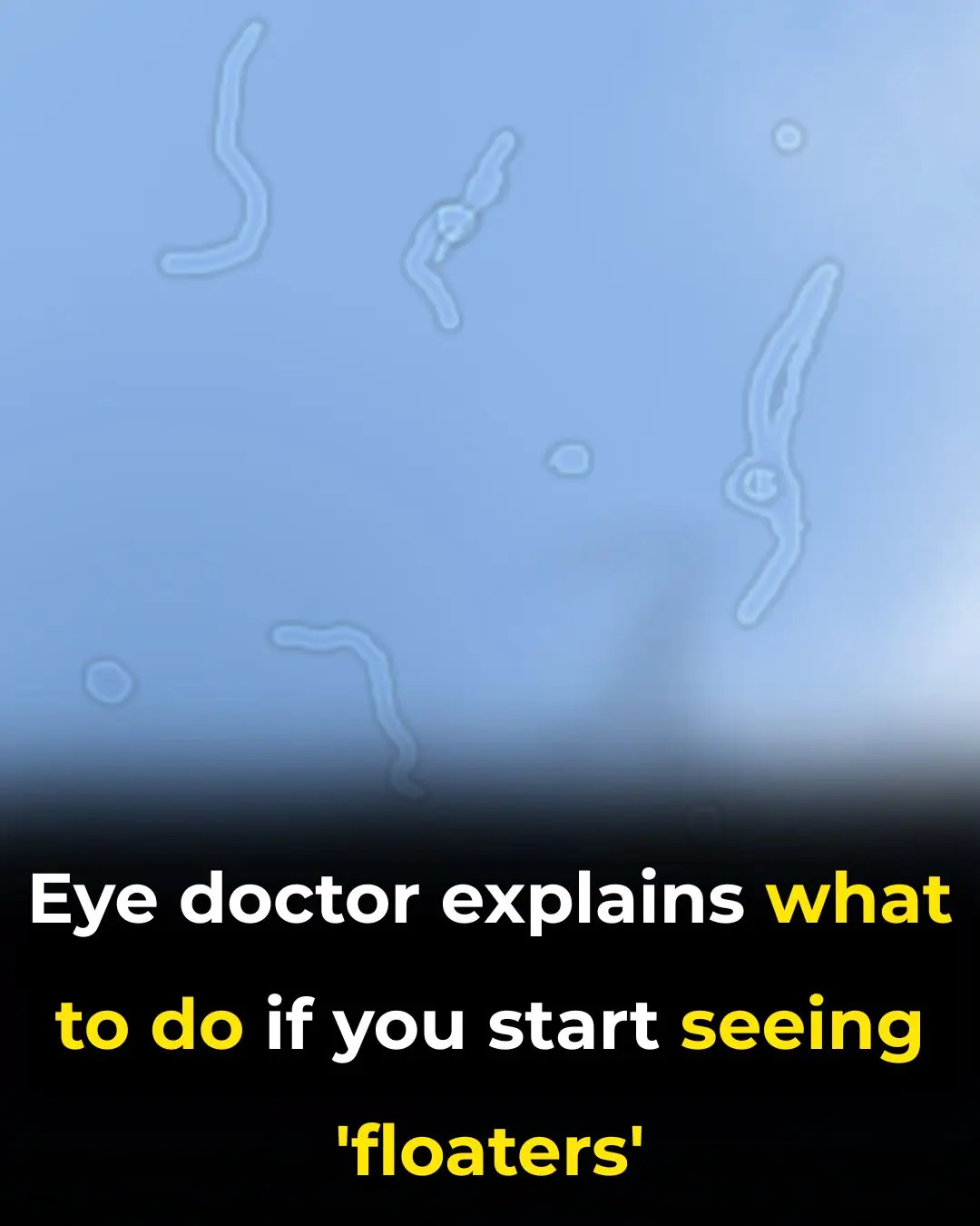 Understanding Eye Floaters: Causes and When to Seek Help