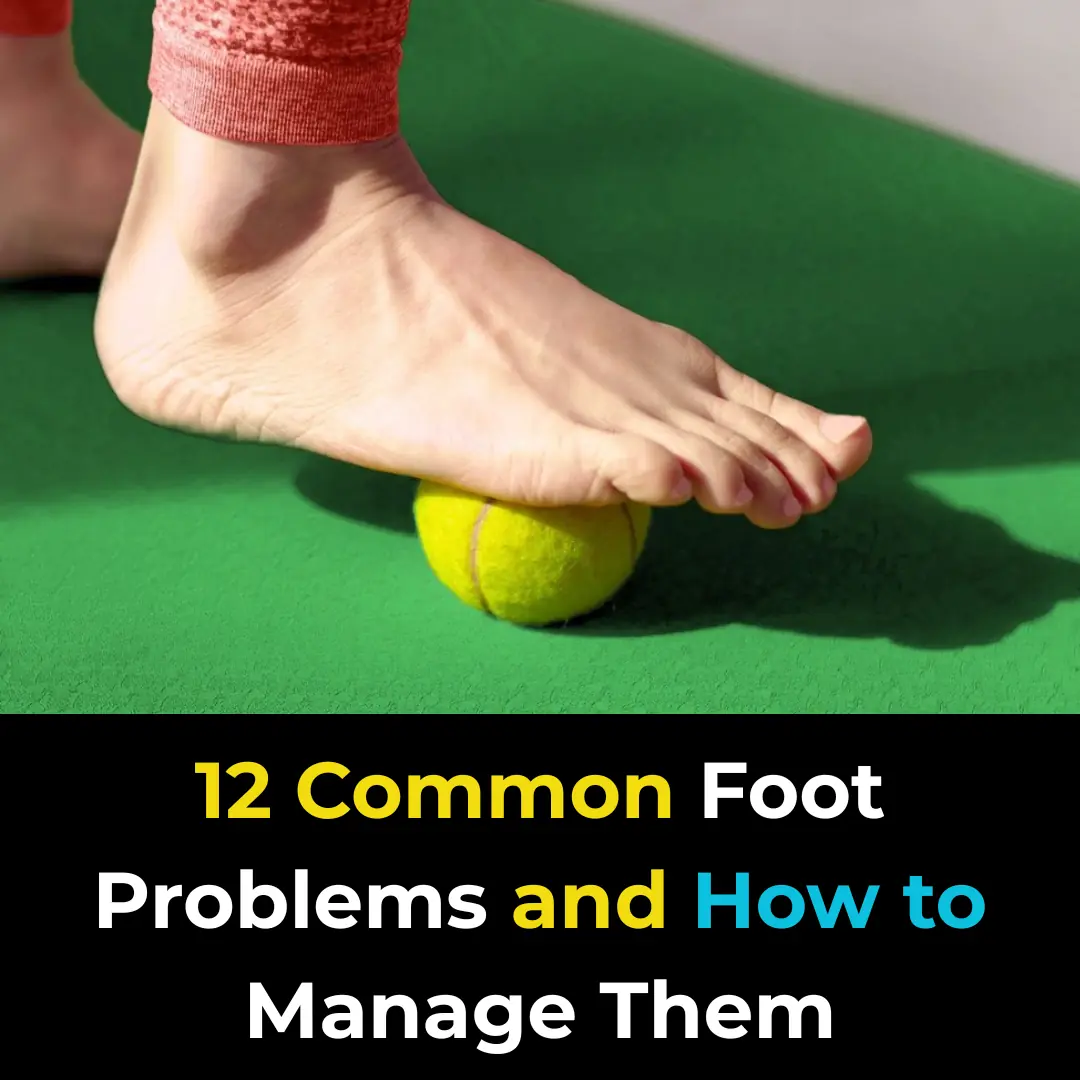 12 Common Foot Problems and How to Manage Them