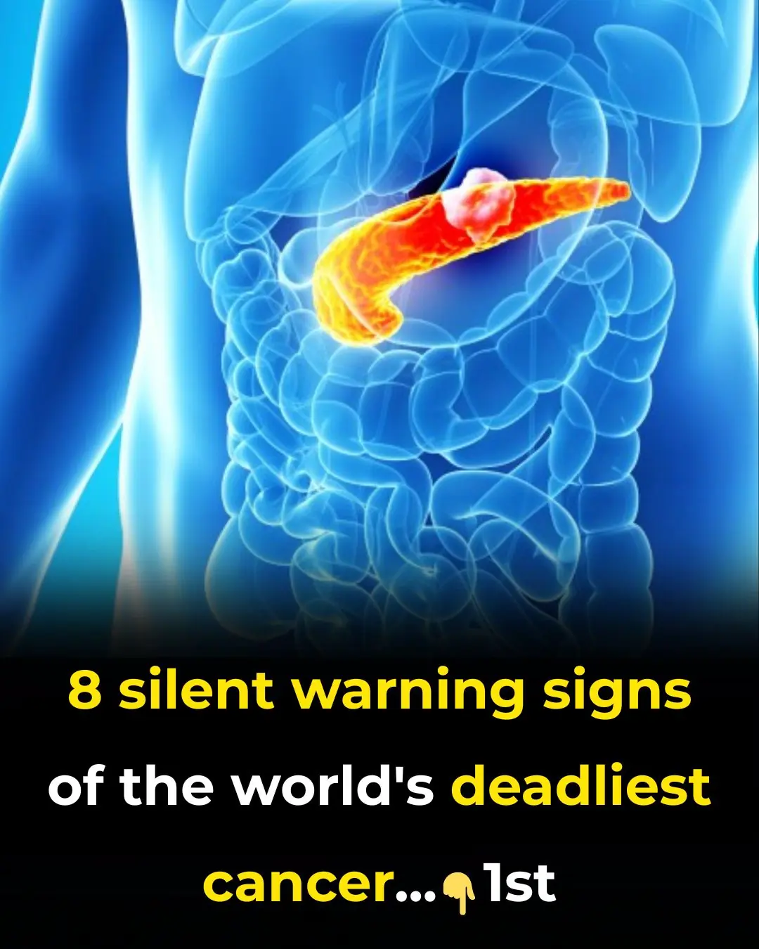 World’s deadliest cancer: 8 early warning signs every older adult should know