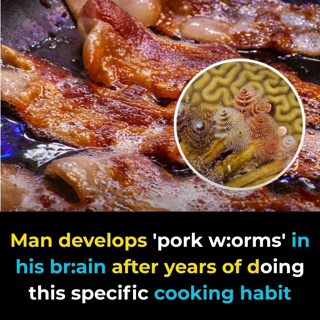 Man develops 'pork worms' in his brain after years of doing this specific cooking habit