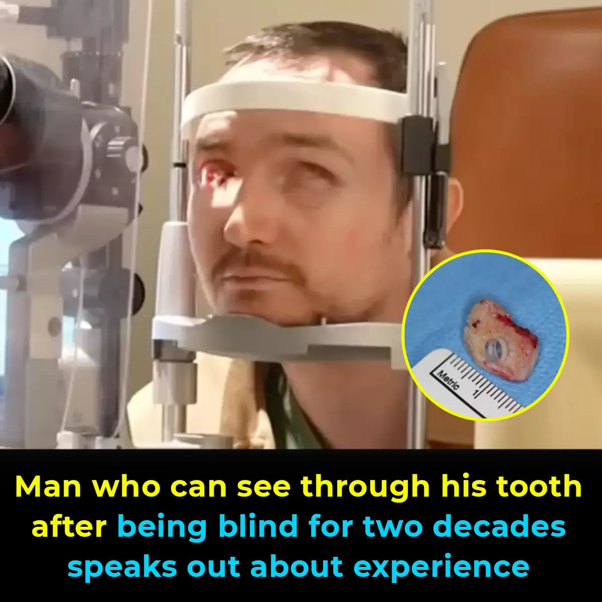 Man who can see through his tooth after being blind for two decades speaks out about experience